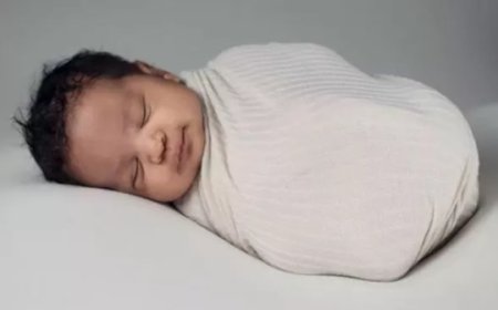 Memahami Bahaya Bayi Lepas Panggul dan Faktor Risiko Terkait