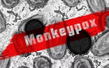 Warga Jakarta Barat Terinfeksi Cacar Monyet, 8 Kasus Tersebar di 6 Kecamatan