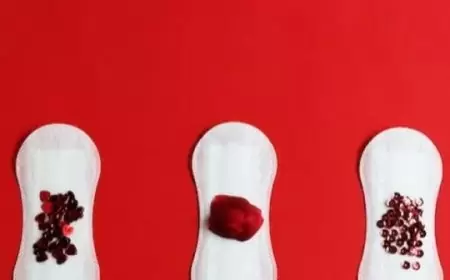 Menanggapi Tantangan Sakit Haid: Pil KB Modern dengan Drospirenon sebagai Solusi Efektif untuk Redakan Gejala PMS dan PMDD