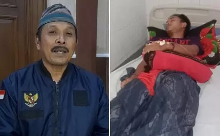 Kuli Bangunan di Bondowoso Ngaku Dianiaya Oknum Polisi sampai Opname, Tokoh Masyarakat Ini Klaim Nihil Penganiayaan