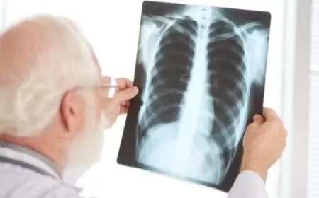 Penyakit Paru Obstruktif Kronis (PPOK): Ancaman Global yang Memerlukan Perhatian Serius