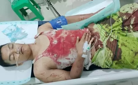 Gagalkan Aksi Curanmor, Berlumuran Darah Dibacok Pelaku