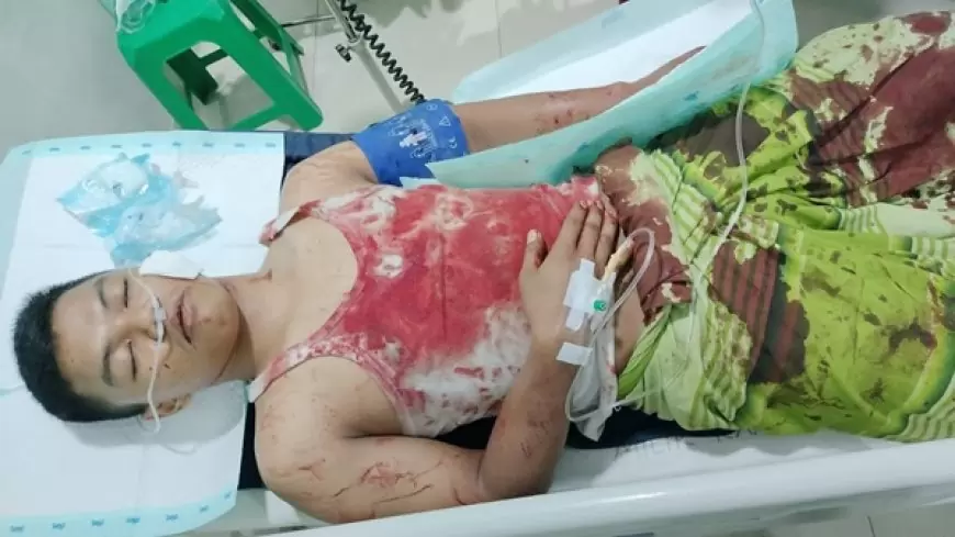 Gagalkan Aksi Curanmor, Berlumuran Darah Dibacok Pelaku