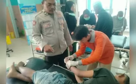 Bocah 14 Tahun Alami Luka Bakar Akibat Bermain Mercon di Situbondo