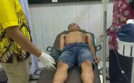 Anak Anggota DPRD Surabaya Dilaporkan ke Polrestabes, Ini Kronologisnya