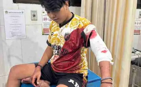 Seorang Pemuda di Driyorejo Gresik Alami Luka Bacok Akibat Aksi Brutal Kawanan Gangster 