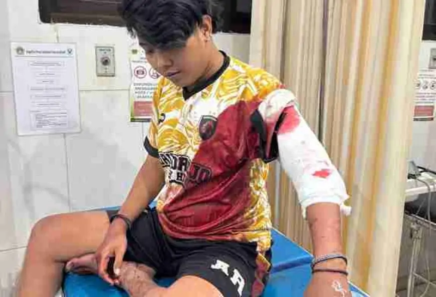Seorang Pemuda di Driyorejo Gresik Alami Luka Bacok Akibat Aksi Brutal Kawanan Gangster 