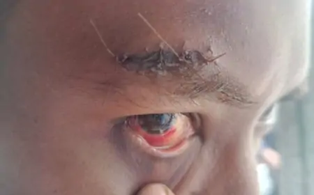 Penjual Tahu Ledokombo Jadi Korban Penganiayaan, Diduga Dilakukan Oknum Perangkat Desa