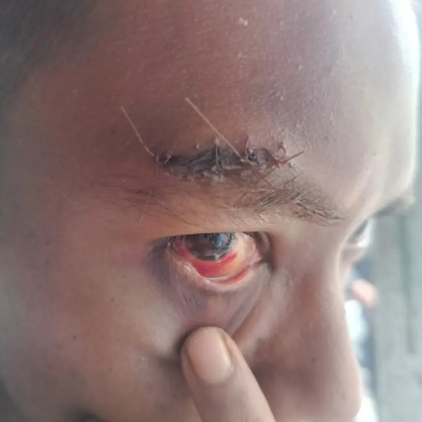 Penjual Tahu Ledokombo Jadi Korban Penganiayaan, Diduga Dilakukan Oknum Perangkat Desa