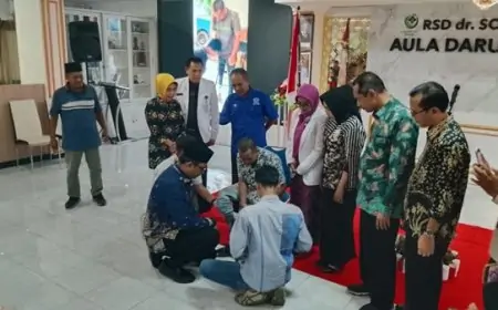 RSD Soebandi Fasilitasi Operasi Bibir Sumbing dan Bantuan Kaki Tangan Palsu