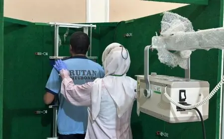 Cegah Penularan TBC, Rutan Situbondo Gelar Skrining Massal dan Pemeriksaan Rontgen bagi Warga Binaan