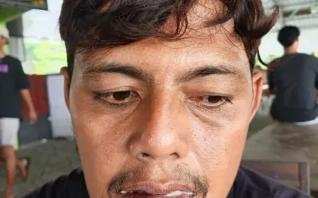 Dianiaya OTK Saat Antre BBM di SPBU Sembayat, Warga Manyar Alami Luka di Mata