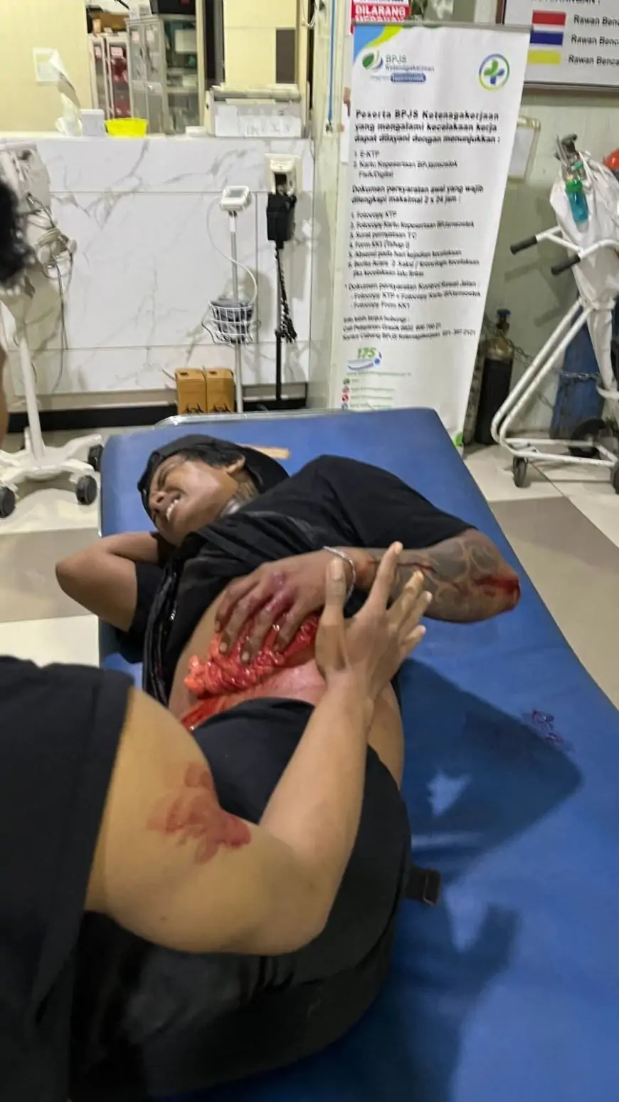 Tawuran Antar Desa Saat Patroli Sahur di Panceng Gresik, Dua Pemuda Disabet Pedang