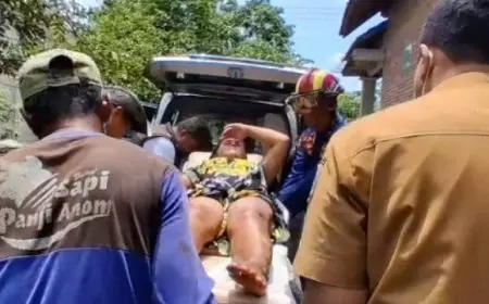 Petaka Botol Bensin Retak di Kauman Tulungagung: Sambar Api Tungku, Kaki Seorang Wanita Alami Luka Bakar