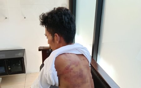 Dituduh Curi Besi Bekas di Kebet Lamongan, Dua Pria Babak Belur Dihajar Massa dan Disiram Garam